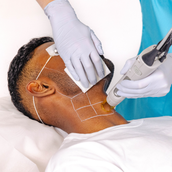 Laser Hair Removal - Neck