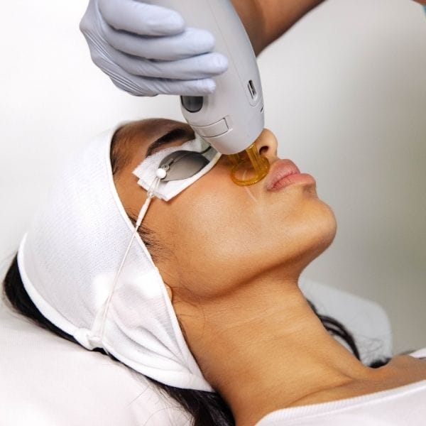 Laser Hair Removal - Lip+Chin