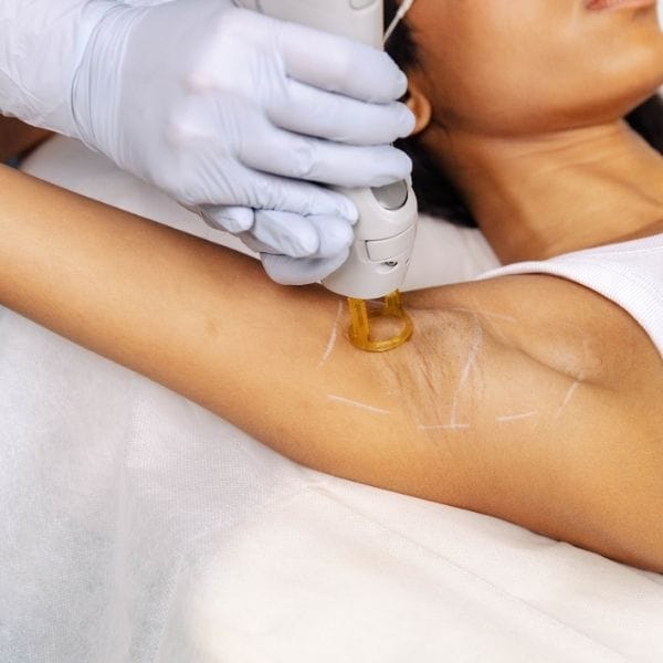 Laser Hair Removal - Brazilian+Underarms+Full Legs