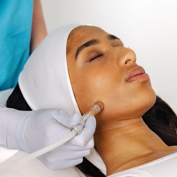 SKIN - ADD Classic Microdermabrasion
