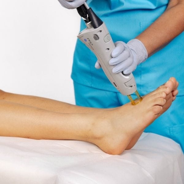 Laser Hair Removal - Feet+Toes